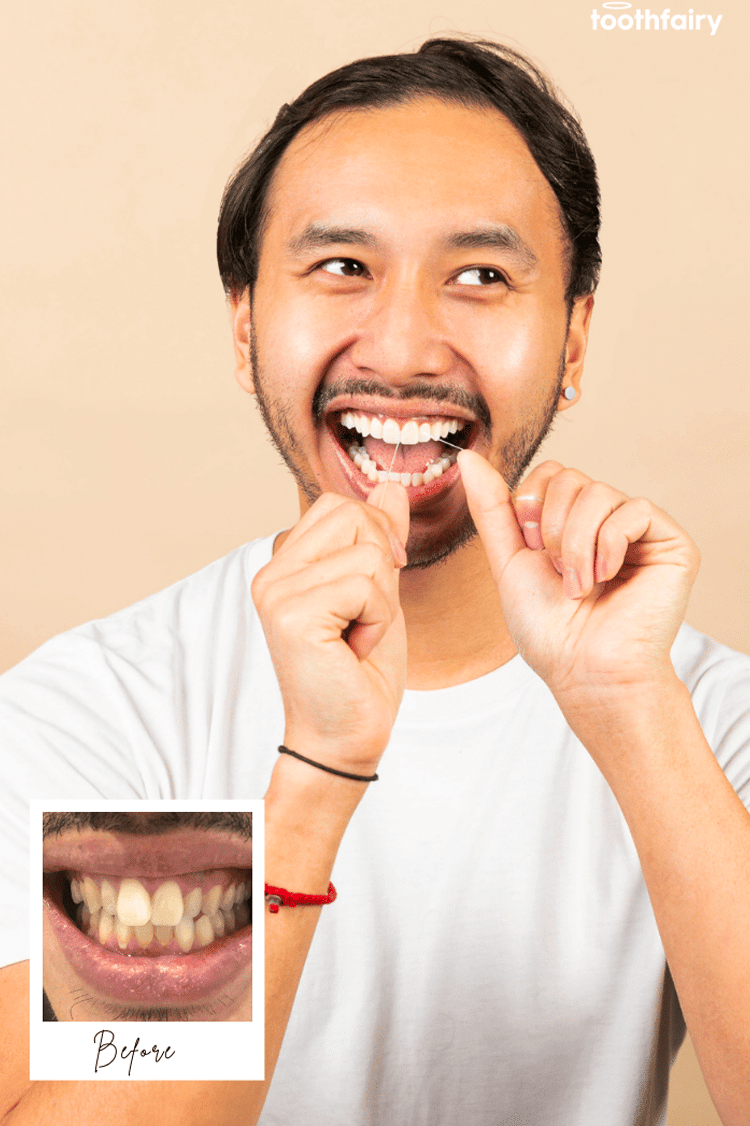 Toothfairy