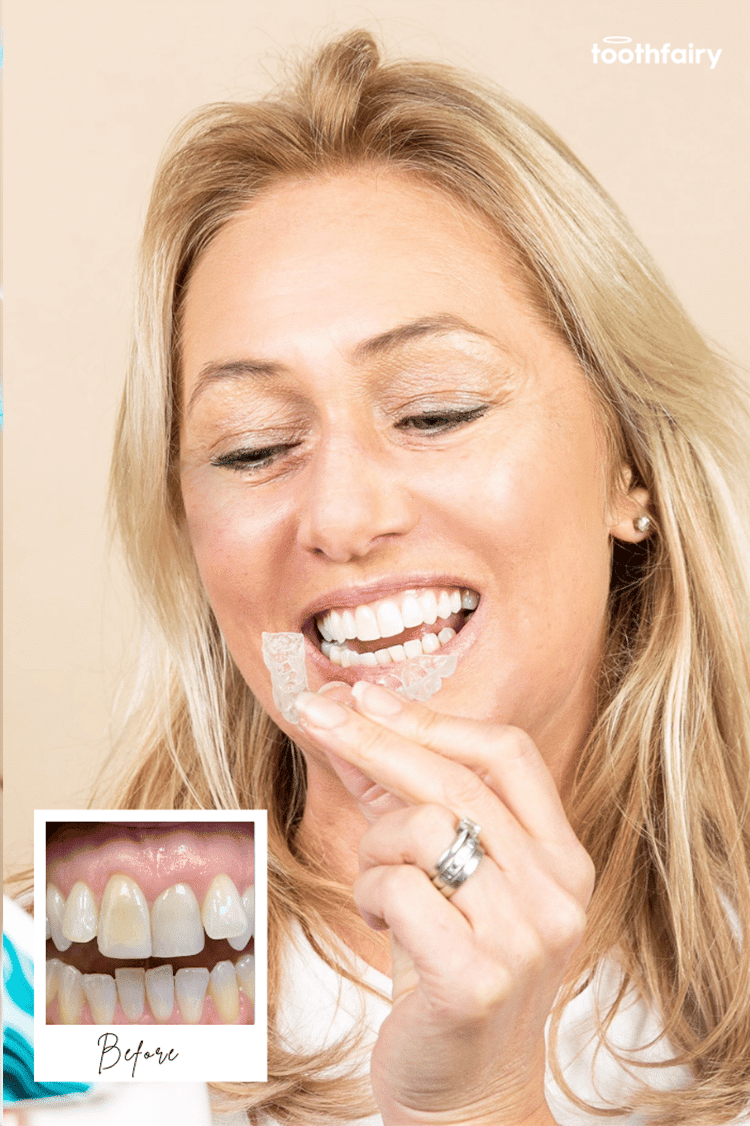 Toothfairy
