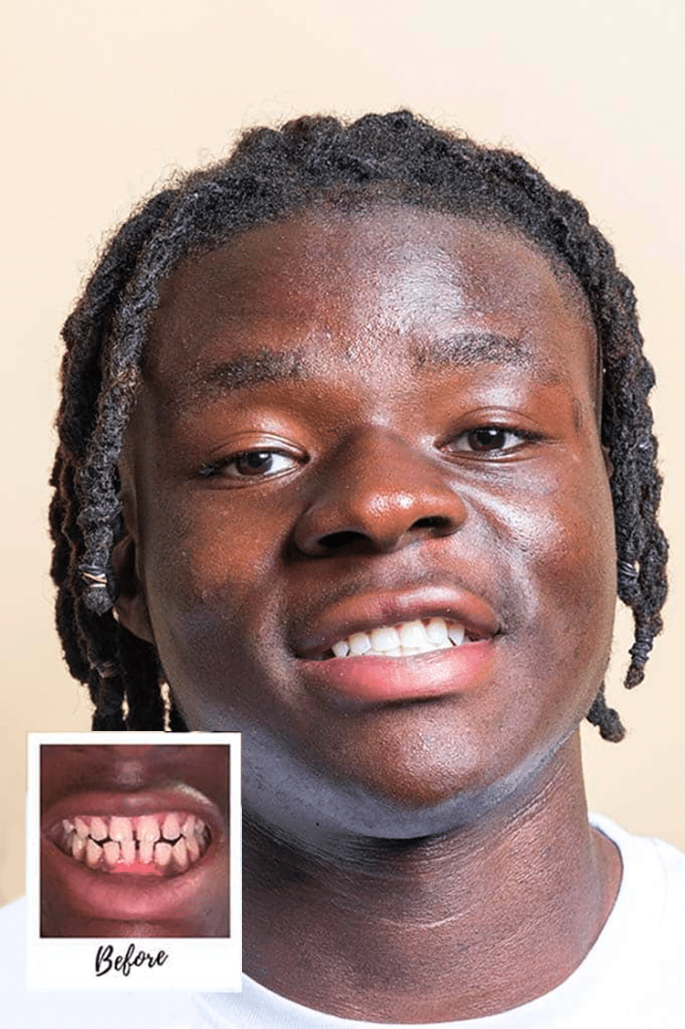 Toothfairy