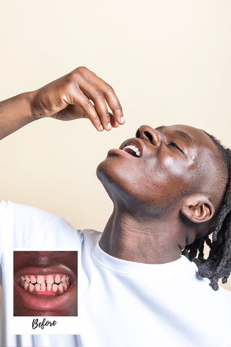 Toothfairy