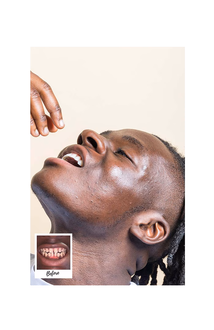 Toothfairy - Planned to perfection